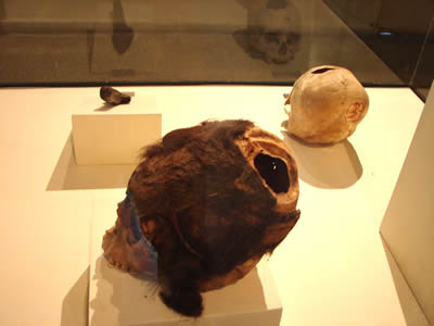 MUSEO REGIONAL DE ICA TREPANACION CRANEANA 04